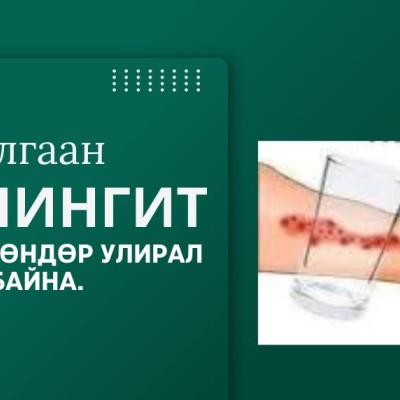 ДАРХАН-УУЛ АЙМАГТ МЕНИНГОКОККТ ӨВЧНИЙ ТОХИОЛДОЛ БҮРТГЭГДЛЭЭ | HuduuMN